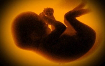 Abtreibung: Schweden bestraft Gewissensverweigerung